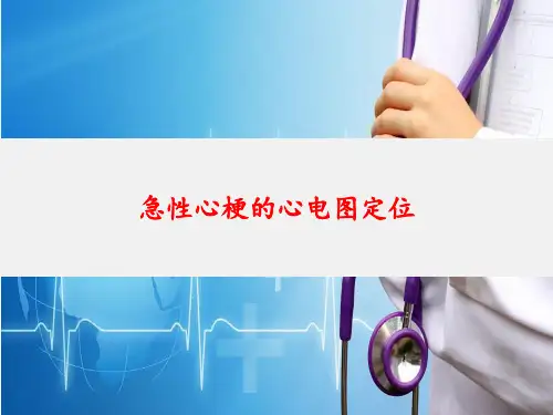 急性心梗的心电图定位