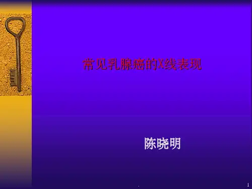 乳腺癌的常见钼靶表现ppt课件ppt课件