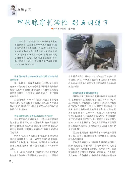 甲状腺穿刺活检别再纠结了