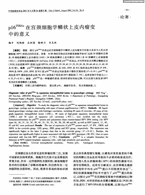 p16 INK4a在宫颈细胞学鳞状上皮内瘤变中的意义