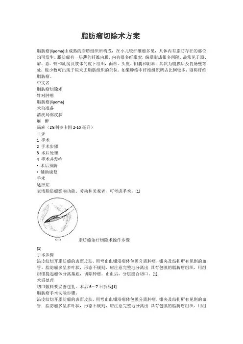 脂肪瘤切除术方案