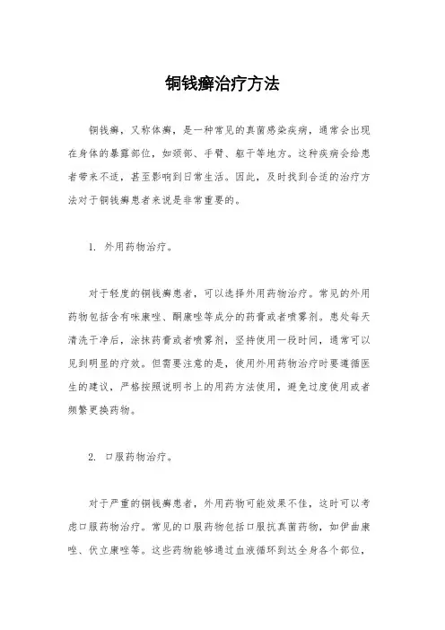 铜钱癣治疗方法