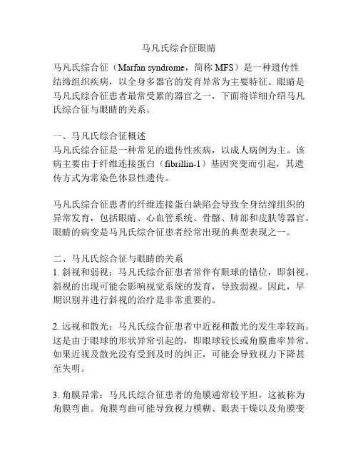 马凡氏综合征眼睛