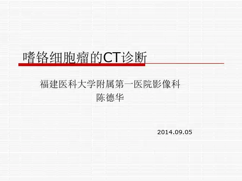 嗜铬细胞瘤的ct诊段
