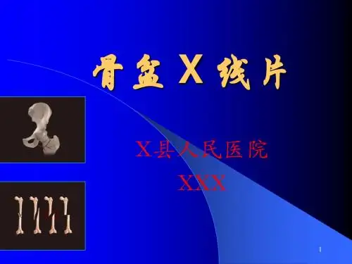 骨盆X线片ppt课件