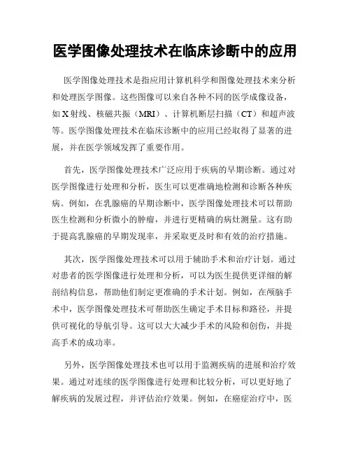 医学图像处理技术在临床诊断中的应用