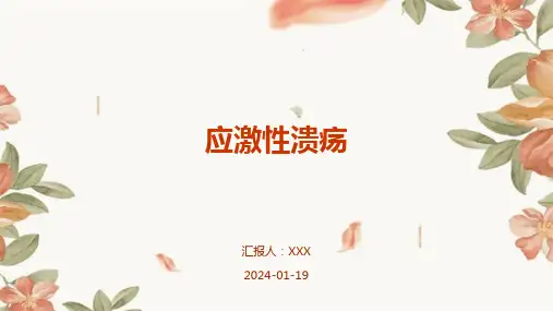 应激性溃疡演示课件