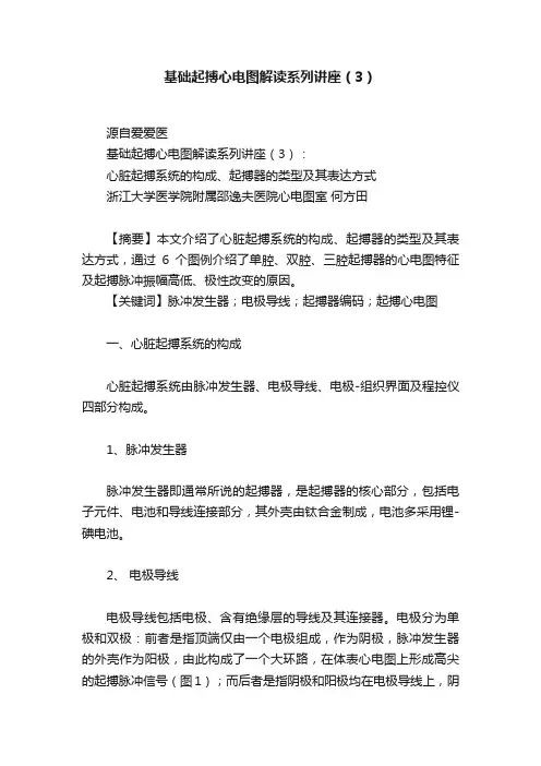 基础起搏心电图解读系列讲座（3）