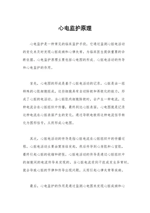 心电监护原理