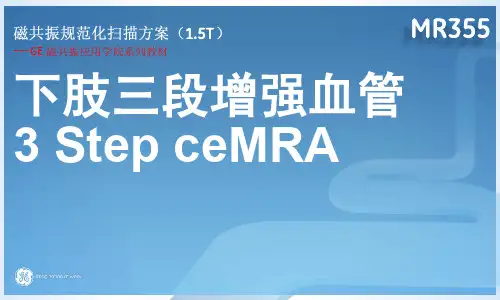 MRI三段增强血管规范化扫描方案