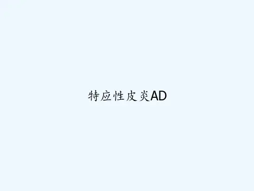 特应性皮炎AD PPT