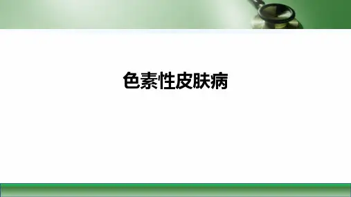 第九版皮肤性病学课件色素性皮肤病