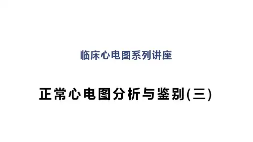 临床心电图系列讲座：正常心电图分析与鉴别(三)