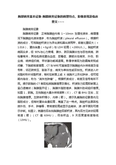 胸部病变基本征象-胸膜病变征象的病理特点、影像表现及临床意义~~~