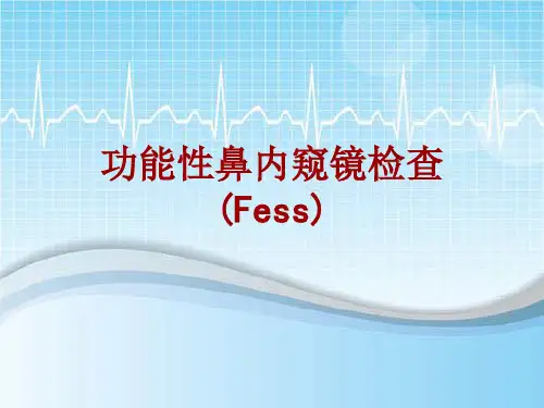 外科手术教学资料：功能性鼻内窥镜检查(Fess)讲解模板