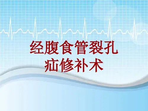 手术讲解模板：经腹食管裂孔疝修补术