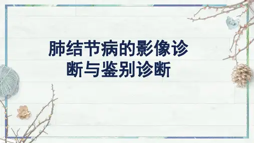 肺结节病的影像诊断与鉴别诊断