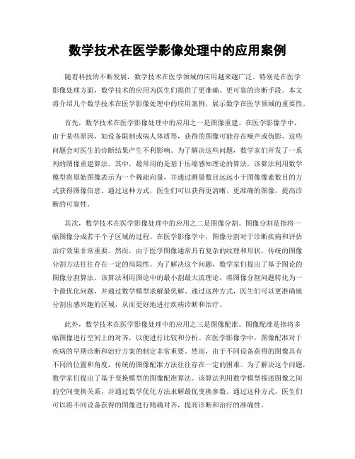 数学技术在医学影像处理中的应用案例