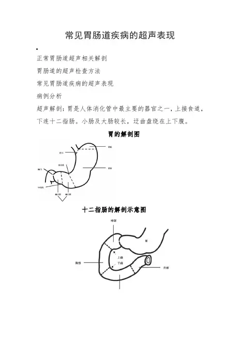 胃部、十二指肠系统解剖图及常见胃肠道疾病的超声表现及影像图