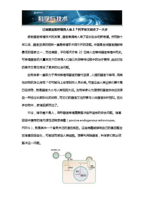 让猪器官能移植到人身上科学家又前进了一大步