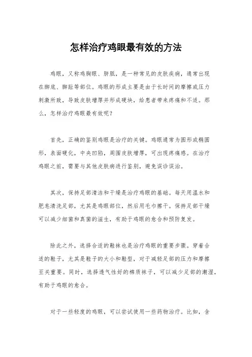 怎样治疗鸡眼最有效的方法