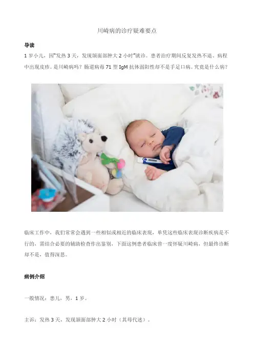 川崎病的诊疗疑难要点