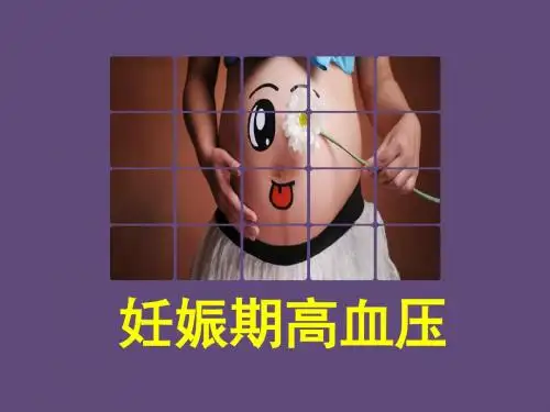 妊娠期高血压PPT模板-1
