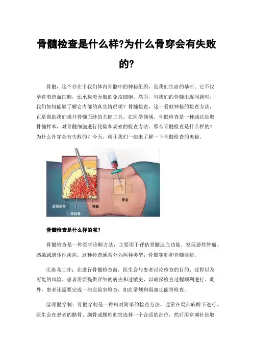 骨髓检查是什么样?为什么骨穿会有失败的?