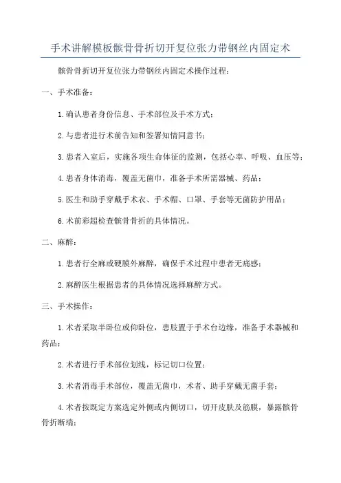手术讲解模板髌骨骨折切开复位张力带钢丝内固定术