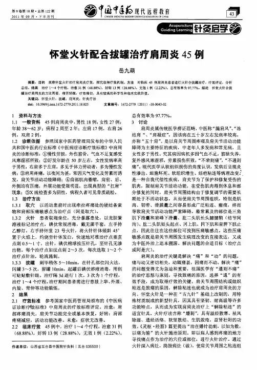 怀堂火针配合拔罐治疗肩周炎45例