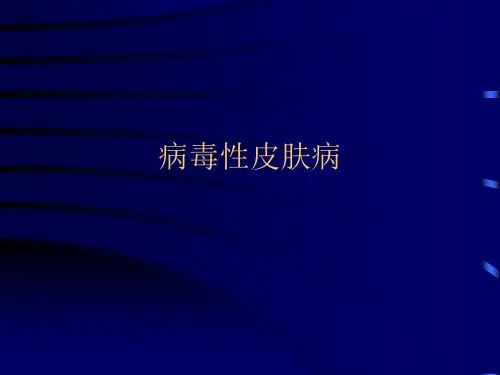 病毒性皮肤病PPT课件