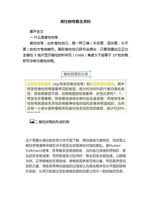 脊柱侧弯最全资料