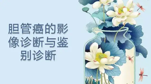 胆管癌的影像诊断与鉴别诊断