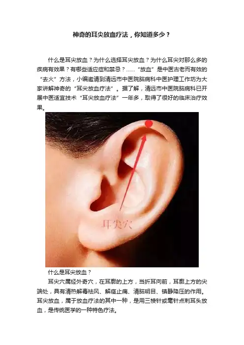 神奇的耳尖放血疗法，你知道多少？