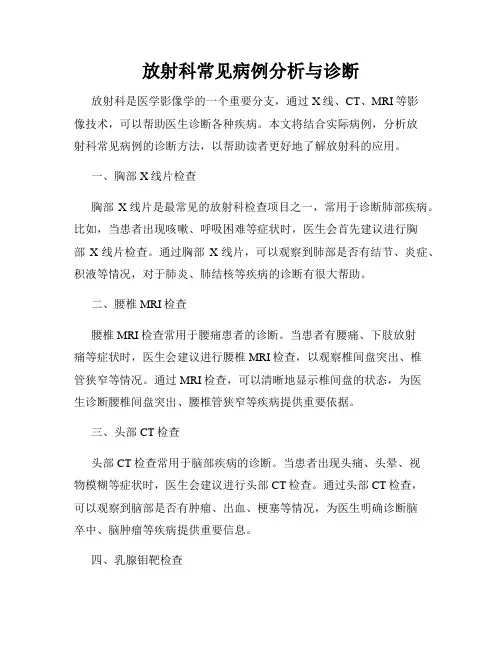 放射科常见病例分析与诊断