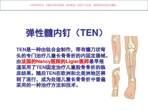 弹性髓内钉讲座课件