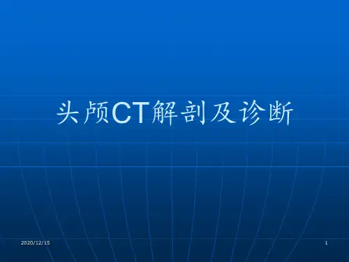 头颅正常CT解剖及诊断 ppt课件