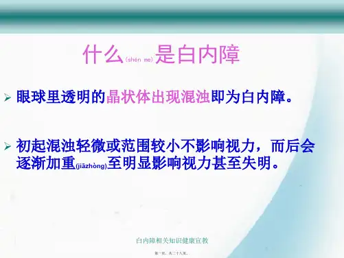 白内障相关知识健康宣教课件