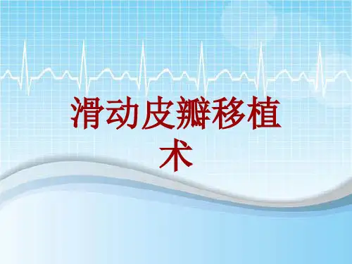 手术讲解模板：滑动皮瓣移植术