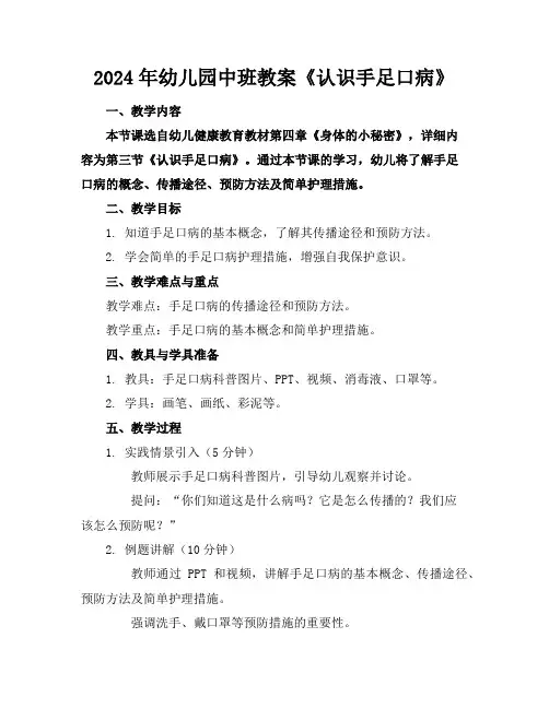 2024年幼儿园中班教案《认识手足口病》