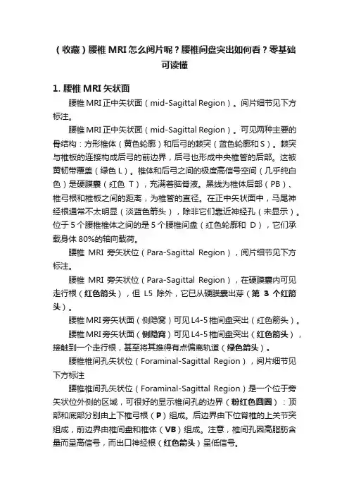 （收藏）腰椎MRI怎么阅片呢？腰椎间盘突出如何看？零基础可读懂