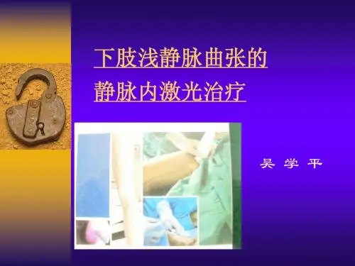 静脉内激光治疗-外科