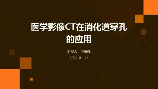医学影像CT在消化道穿孔的应用