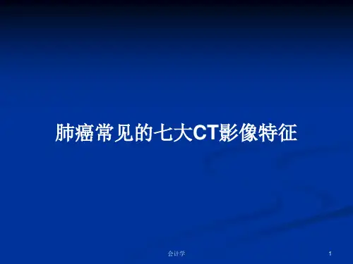 肺癌常见的七大CT影像特征PPT学习教案