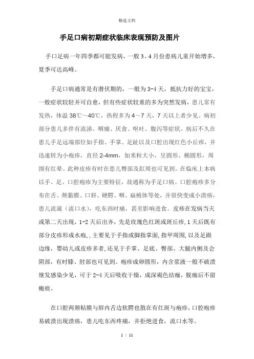 手足口病初期症状及图片doc