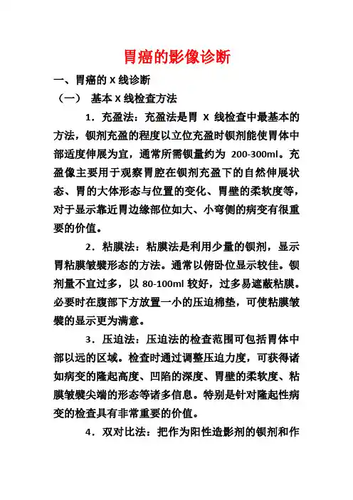 胃癌的影像诊断