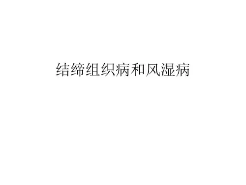 内科学课件：结缔组织病和风湿病