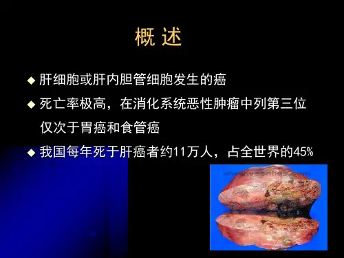 内科学课件原发性肝癌共56页