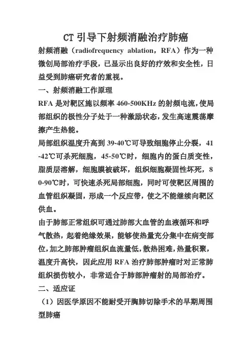 CT引导下射频消融治疗肺癌