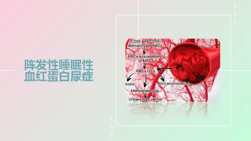 阵发性睡眠性血红蛋白尿症